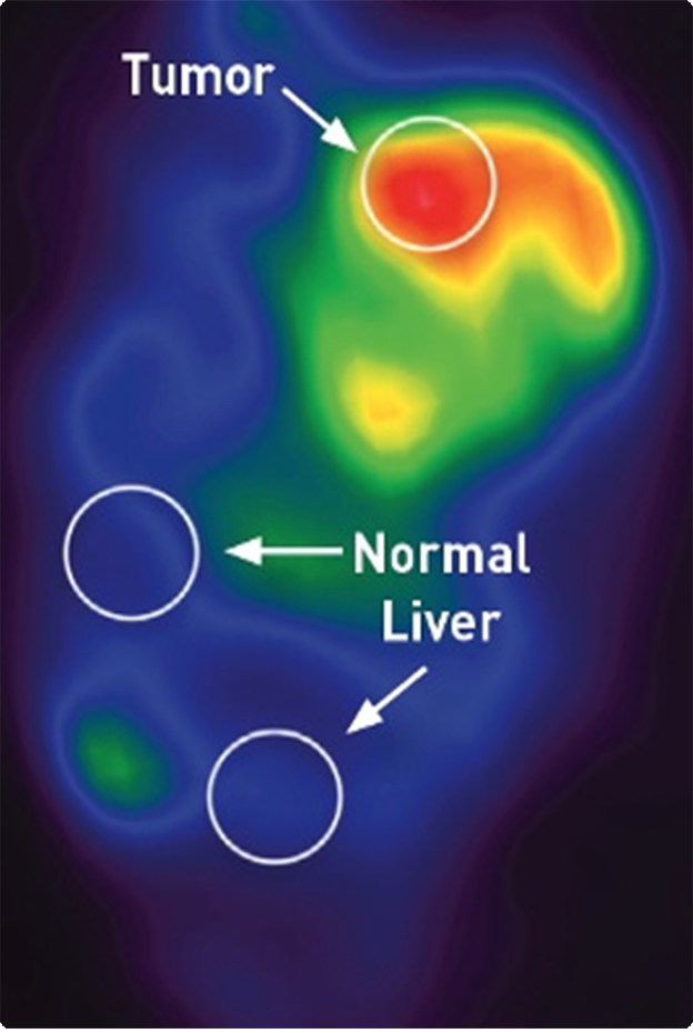 Image showing T:N Ratio 