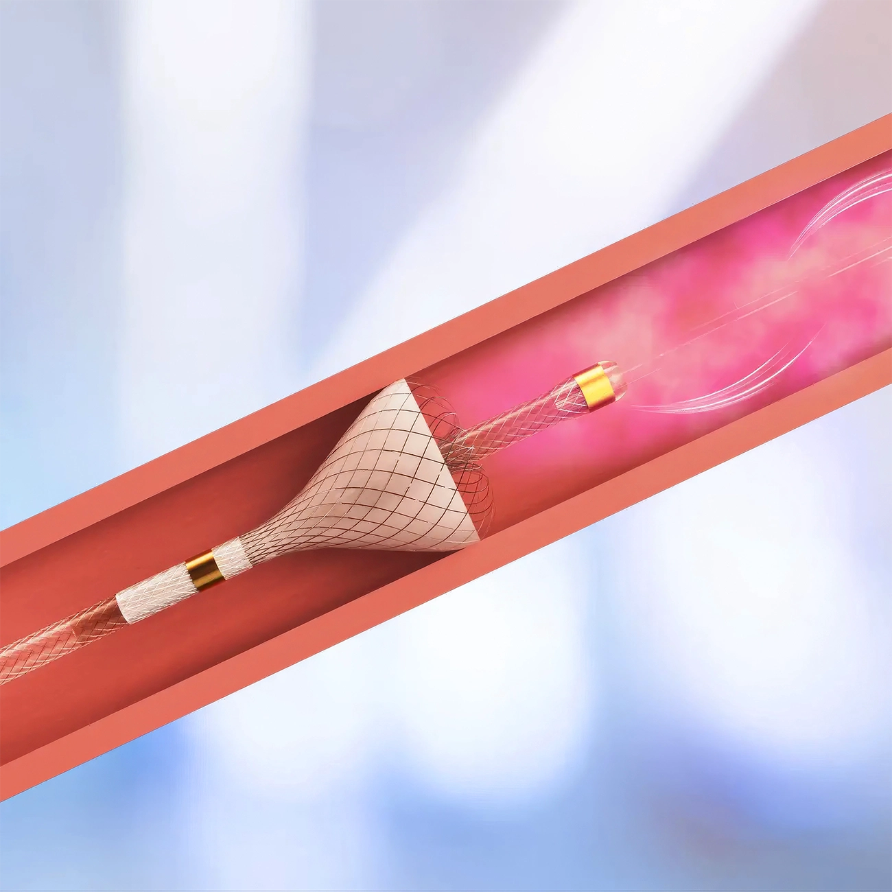 Self Centers Image of TriNav