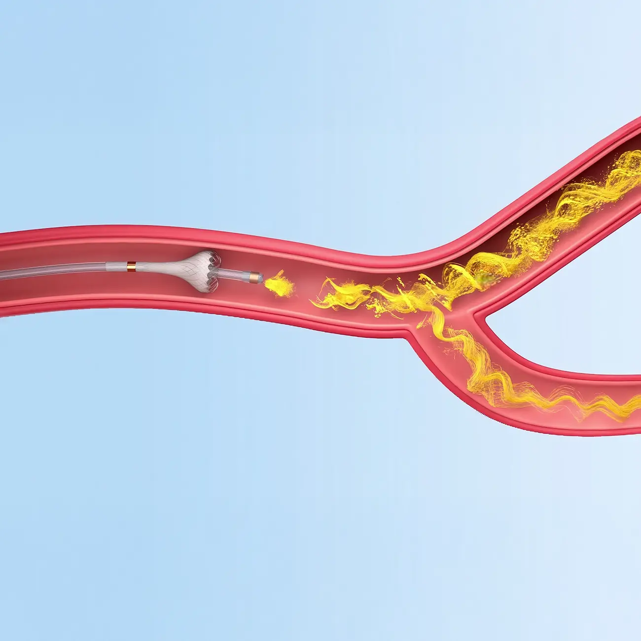 Image of TriNav creating turbulent flow within a vessel 