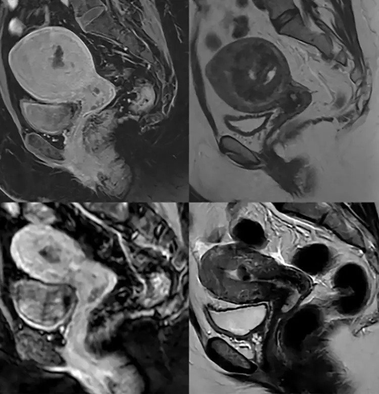 UAE MRI Comparison