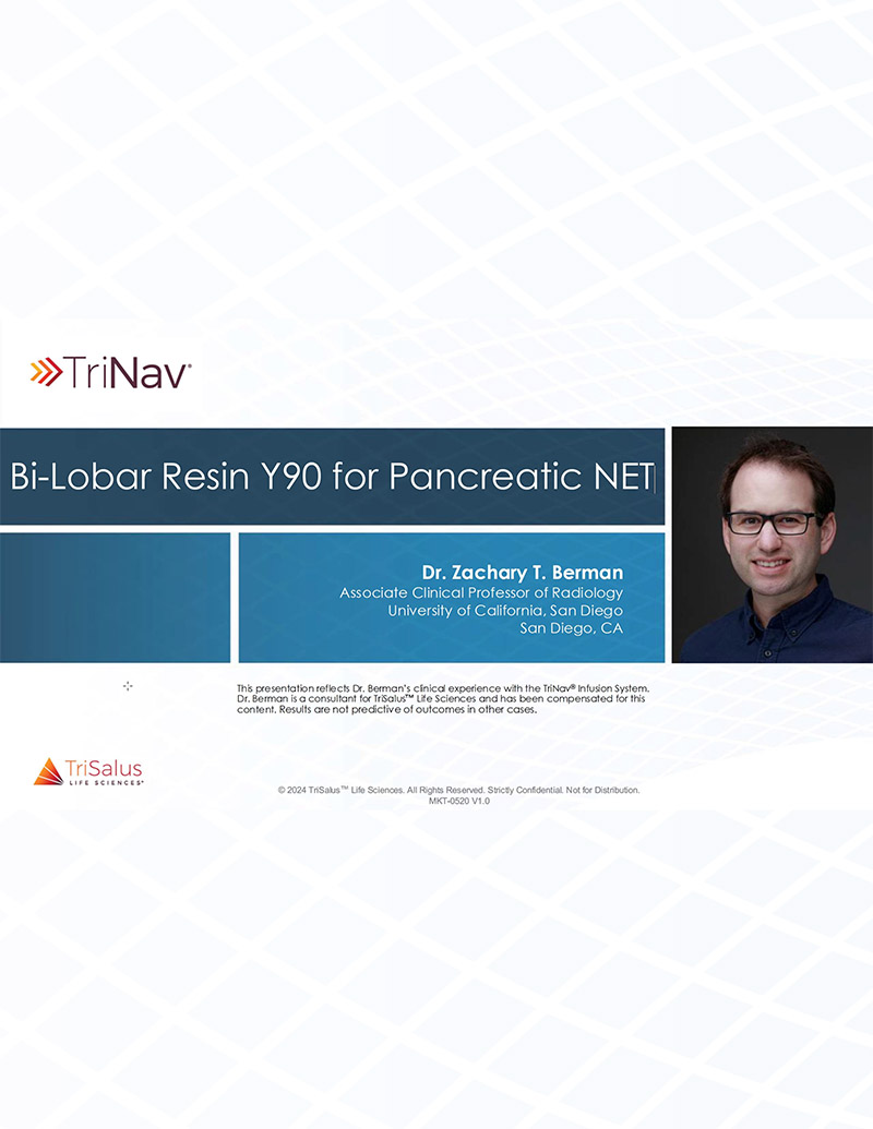 Bi-Lobar Resin Y90 for Pancreatic NET