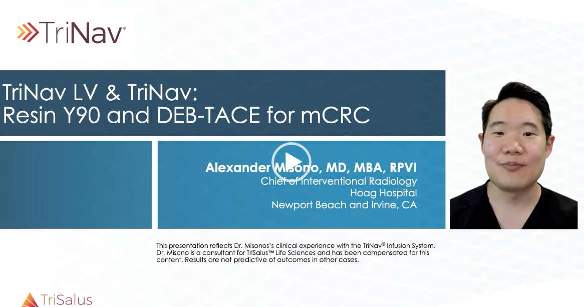 Case Snippet - Resin Y90 with DEB-TACE for mCRC video thumbnail image.