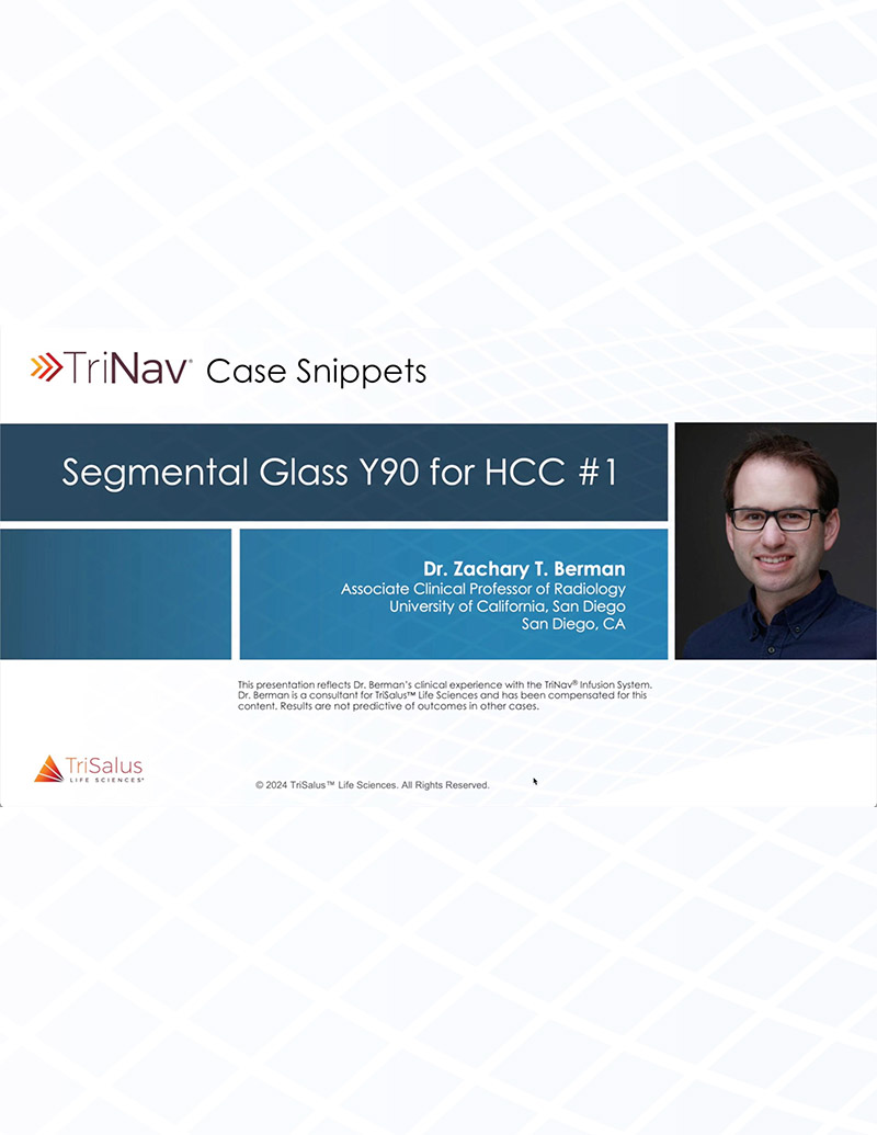 Case Snippet - Segmental Glass Y90 for HCC #1