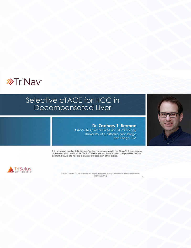 Selective cTACE for HCC in Decompensated Liver